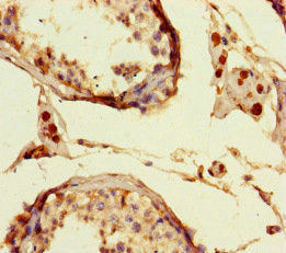 LIG3 Antibody