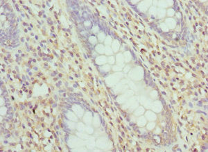 LIMS1 Antibody