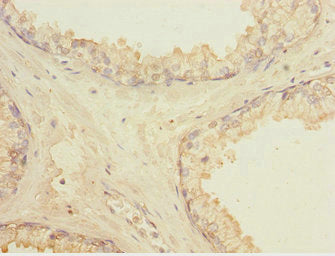 LMO4 Antibody