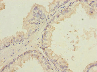 LMO4 Antibody