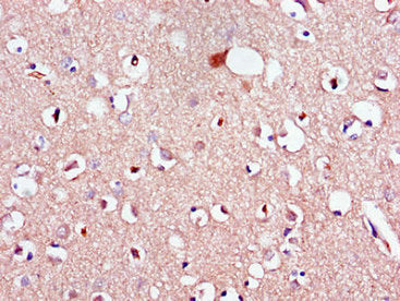 LPAR1 Antibody