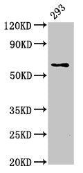 LPCAT2 Antibody