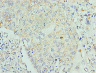 LUM Antibody