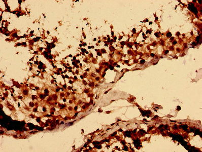 LY6H Antibody