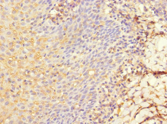LY75 Antibody