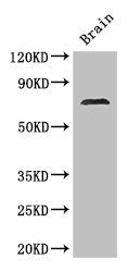 MAK Antibody
