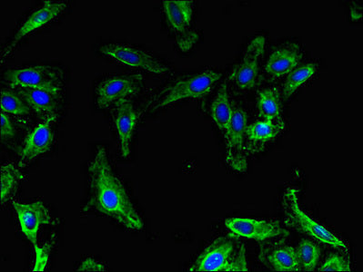 MAP1LC3B2 Antibody