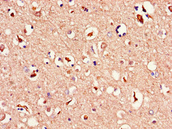 MAPK10 Antibody