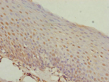 MEOX1 Antibody