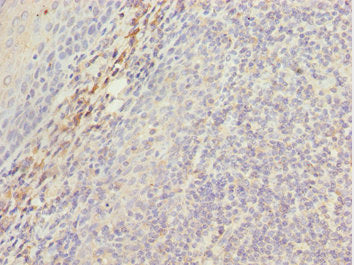 MEOX1 Antibody