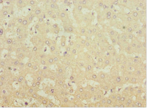 MGAT1 Antibody