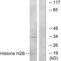 Histone H2B Antibody