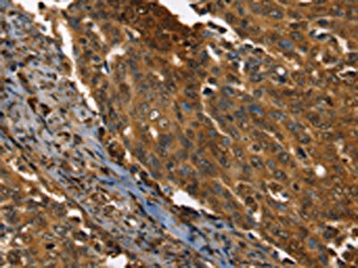 PPIA Antibody
