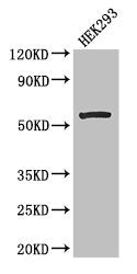 MLYCD Antibody