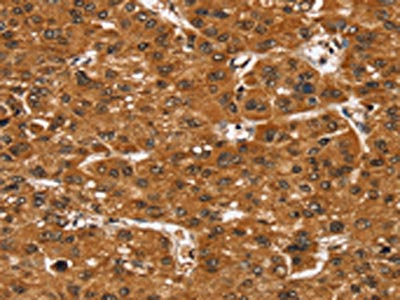 SMARCB1 Antibody