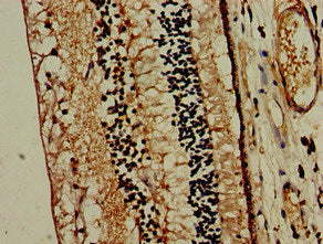 MTNR1B Antibody