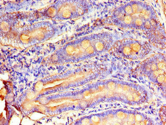 MTTP Antibody
