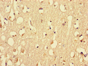 MYH3 Antibody