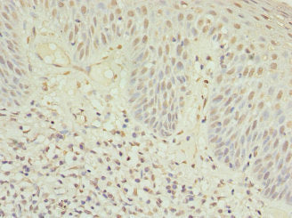 MYO1C Antibody