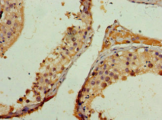 NCOA1 Antibody