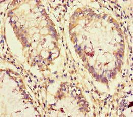 NCOA6 Antibody