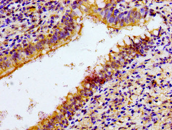NCR3 Antibody
