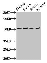 NDUFS2 Antibody