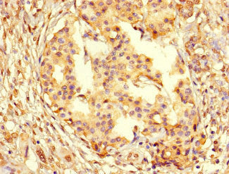 PCNA Antibody