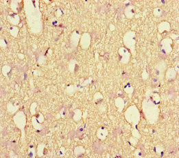NEFL Antibody