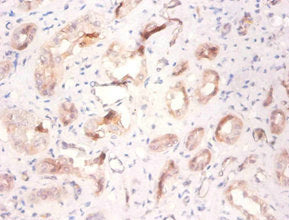 ATP6V1F Antibody
