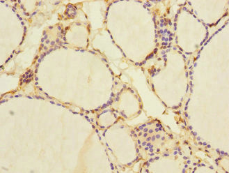 NFKBIE Antibody