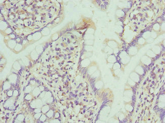 NMU Antibody
