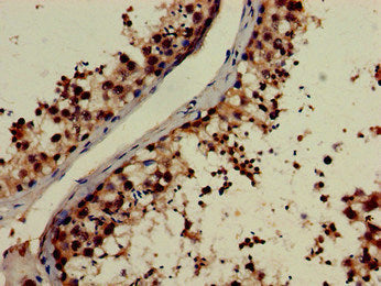 NOG Antibody