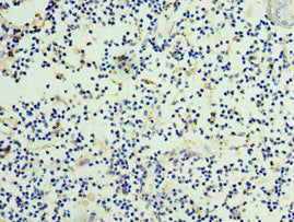 NOV Antibody