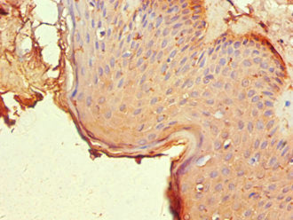 NR2C1 Antibody