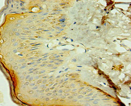 NR2C2 Antibody