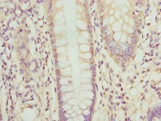 OPHN1 Antibody