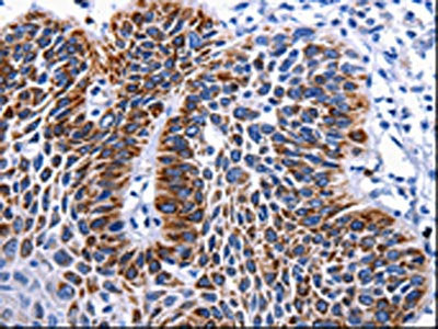 RAB25 Antibody