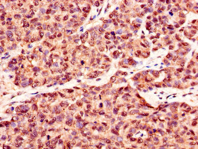 CSNK2B Antibody