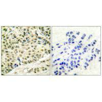 MCM2 Antibody