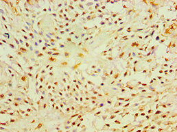 P4HA2 Antibody