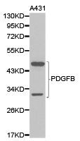 PDGFB Antibody