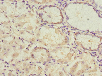 PDHB Antibody