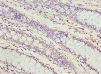 PECR Antibody