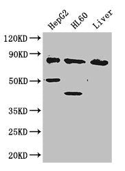 PFKL Antibody