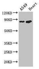 PFKM Antibody