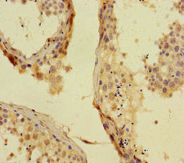 PHC1 Antibody
