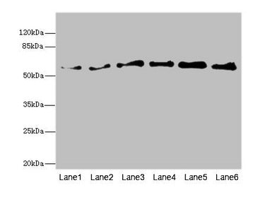 PIP5K1B Antibody