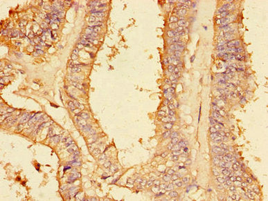 PLA2G4A Antibody