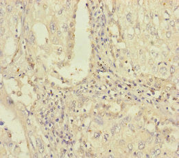 PLAA Antibody